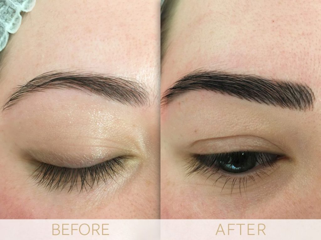 Brittany before and after eyebrow micro pigmentation