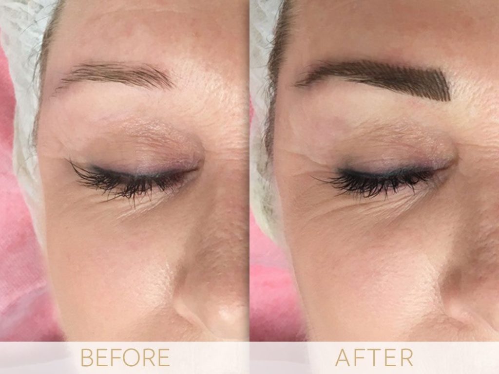 Micropigmentation before & after