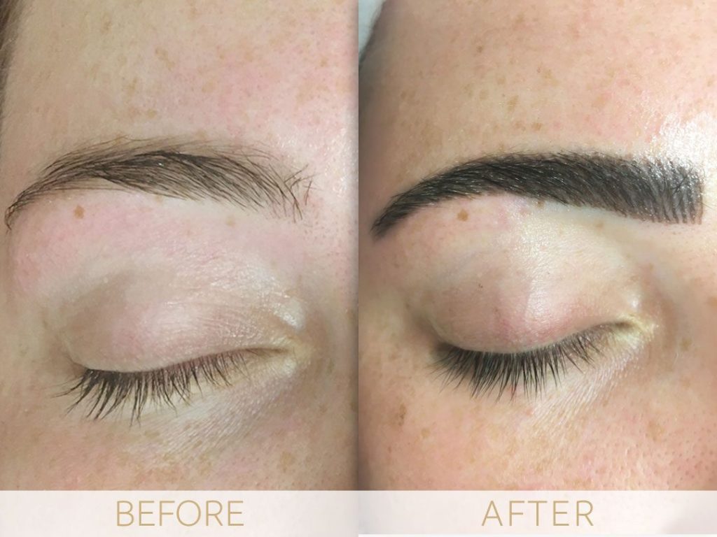 Micropigmentation before & after