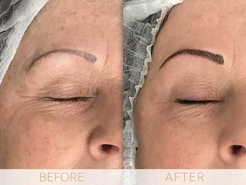 Micropigmentation before & after