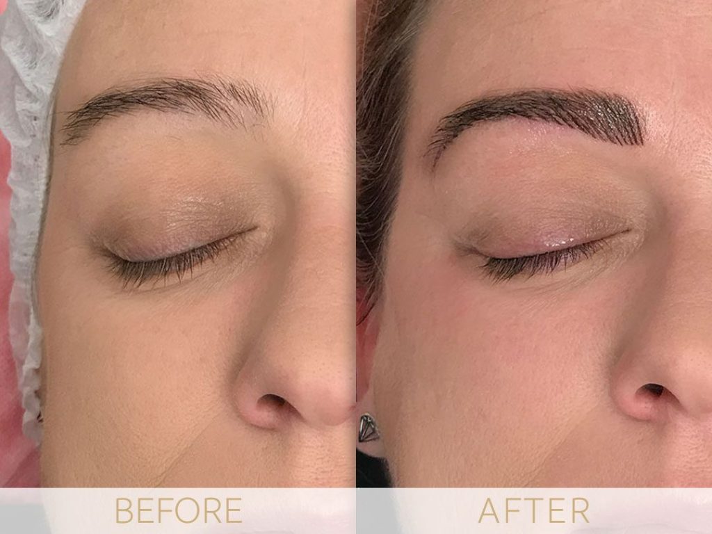 Micropigmentation before & after