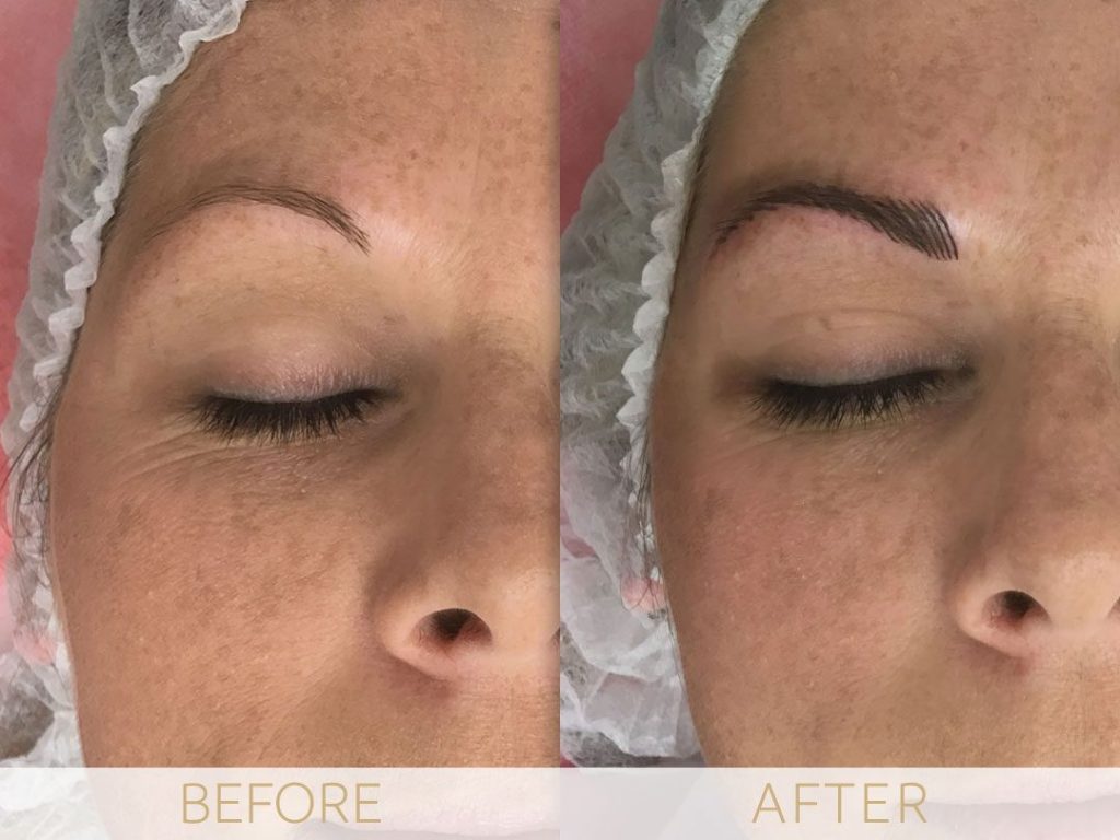 Micropigmentation before & after