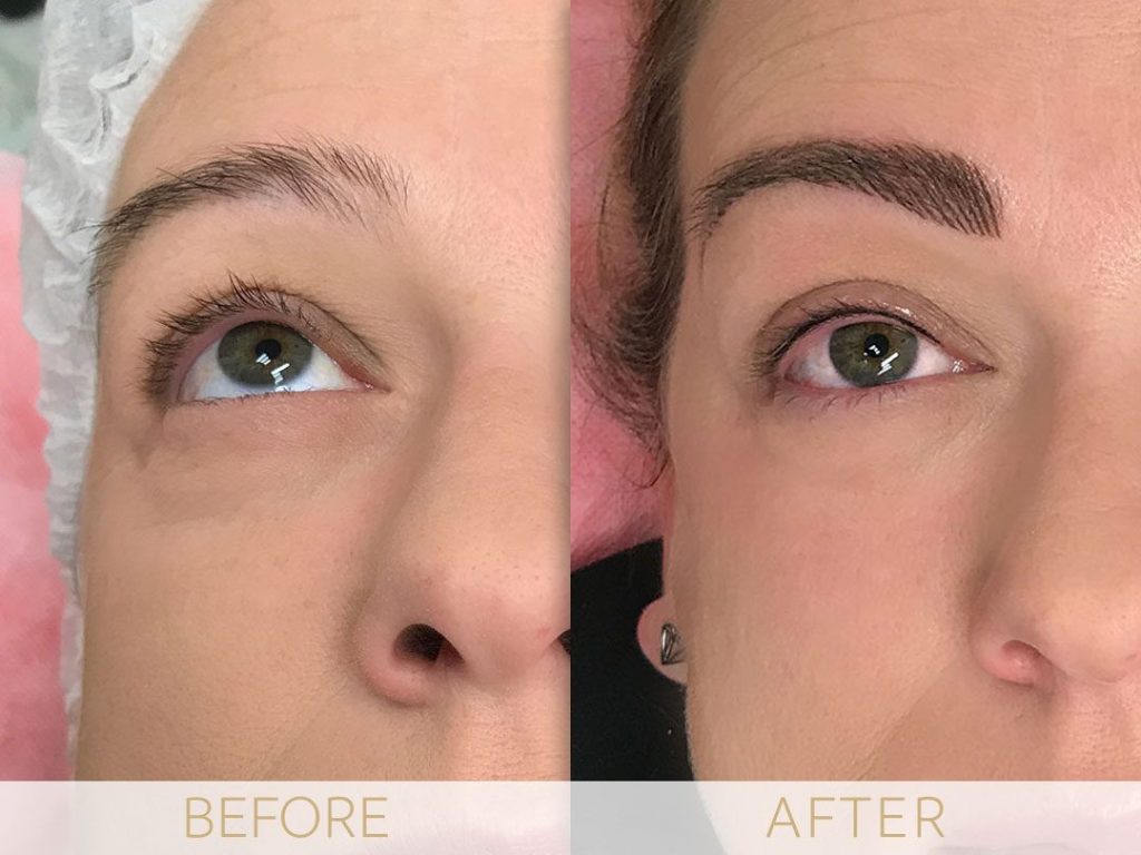 micropigmentation eye-ehancment, before & after