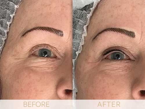 micropigmentation eye-ehancment, before & after