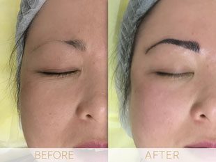 Micropigmentation before & after