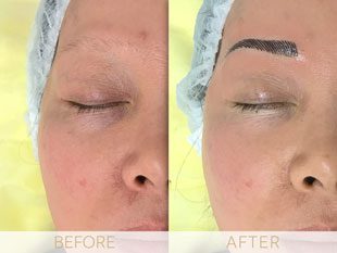 Micropigmentation before & after