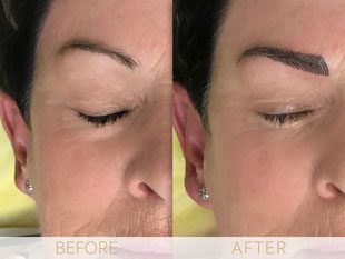 Micropigmentation before & after