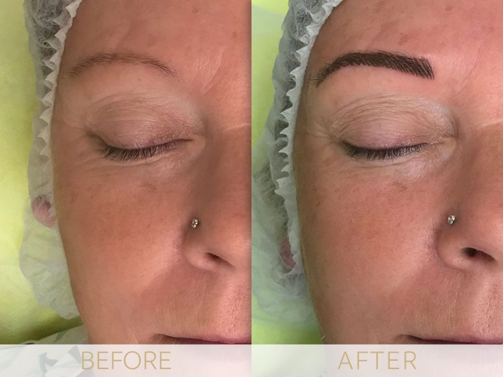 Micropigmentation before & after