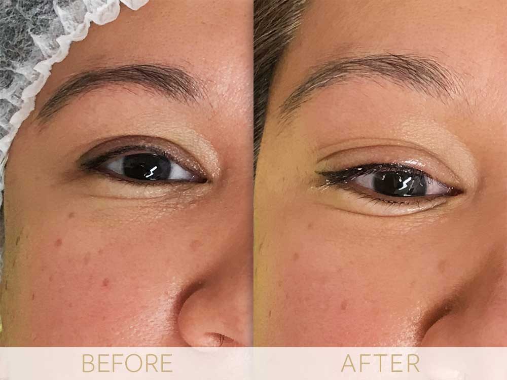 micropigmentation eye-ehancment, before & after