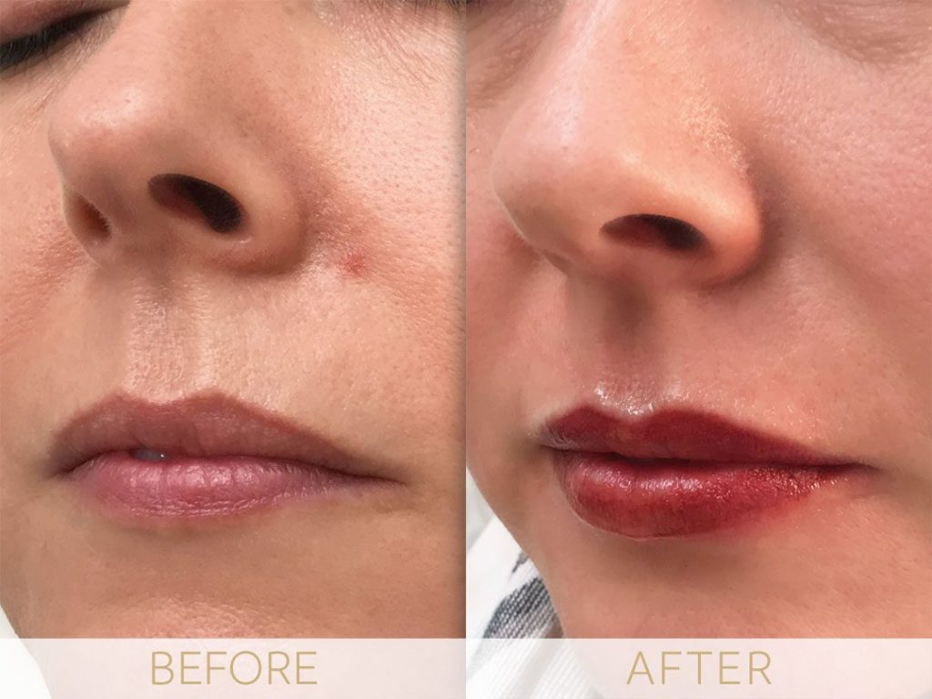 micropigmentation lips before and after