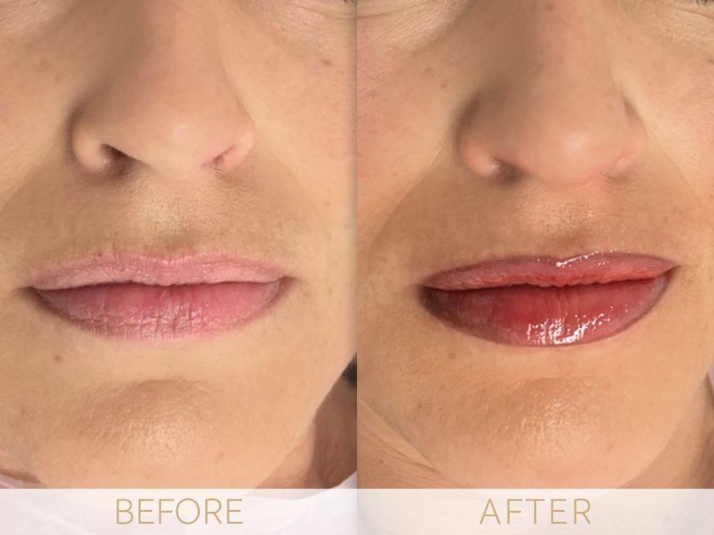 micropigmentation lips before and after