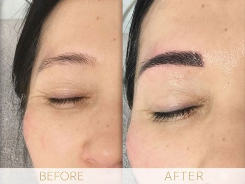 Micropigmentation before & after