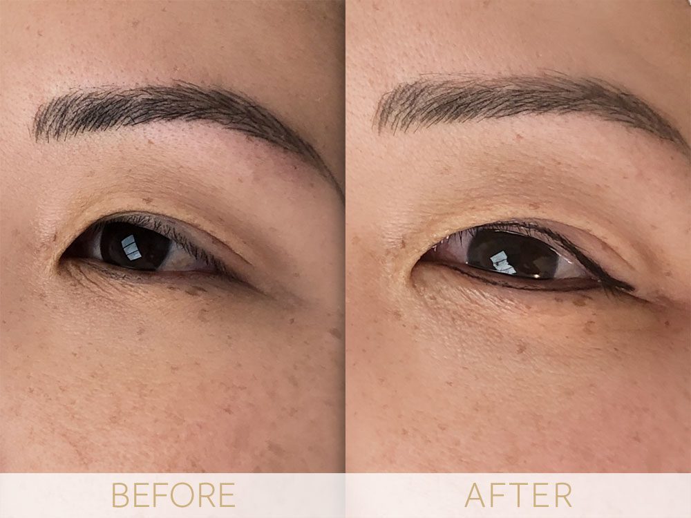 before and after eye enhancement