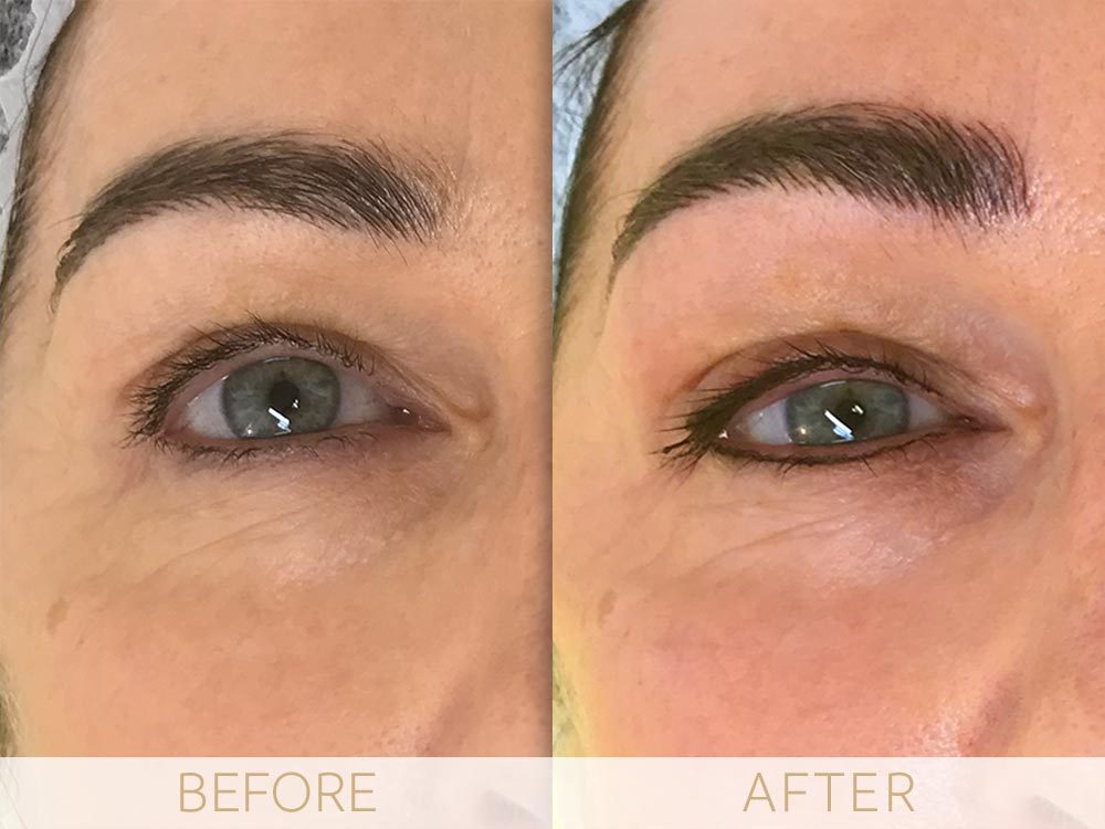 before and after micropigmentation eyes