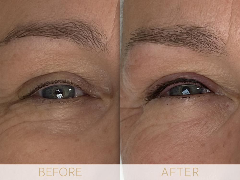 Before & after Micropigmentation eye enhancement