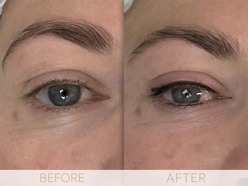 Before & after Micropigmentation eye enhancement