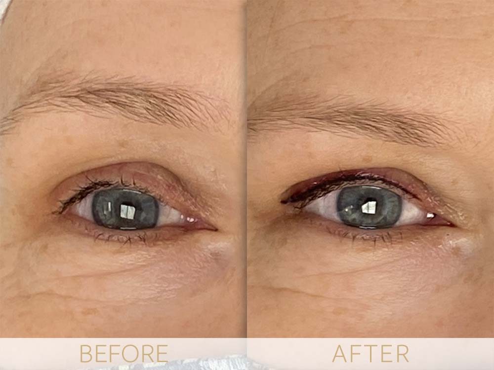 Micropigmentation eye ehancment before & after comparison