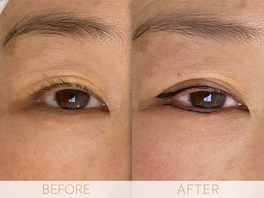 Micropigmentation eye ehancment Before & after comparison