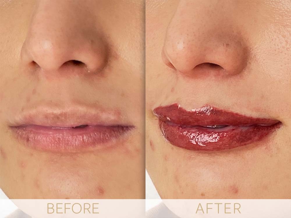 Lip micropigmentation Before & After