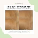 Acacia - Stretchmarks - Highly Commended