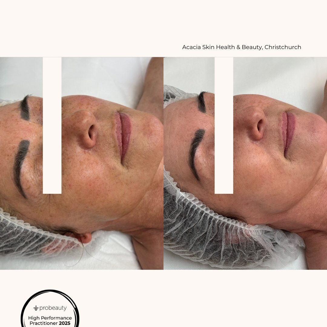 Probeauty - Highly Commended - Skin & Co 2